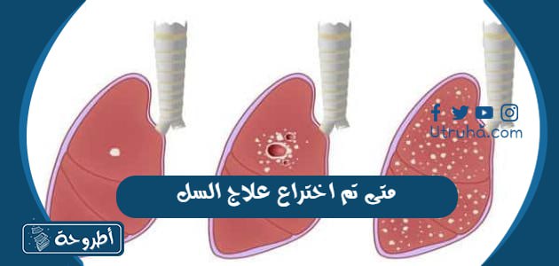 متى تم اختراع علاج السل